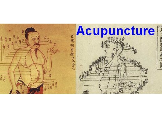 La vérité sur l'acupuncture