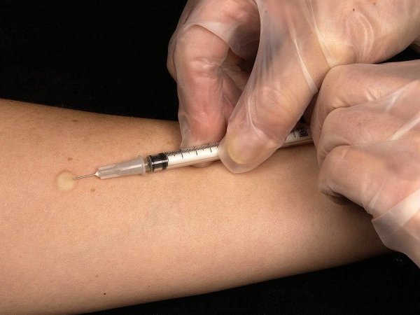 La vaccination contre les papillomavirus : un débat sur des bases irrationnelles