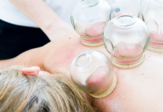 Ventouses, hijama, cupping : une pratique thérapeutique à la mode sans preuve scientifique