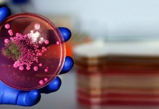 Bactéries et virus : les dangers biologiques des aliments