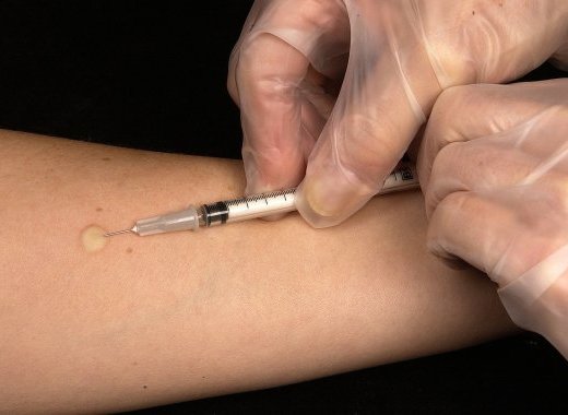 Vaccination : peurs, rumeurs et obscurantisme