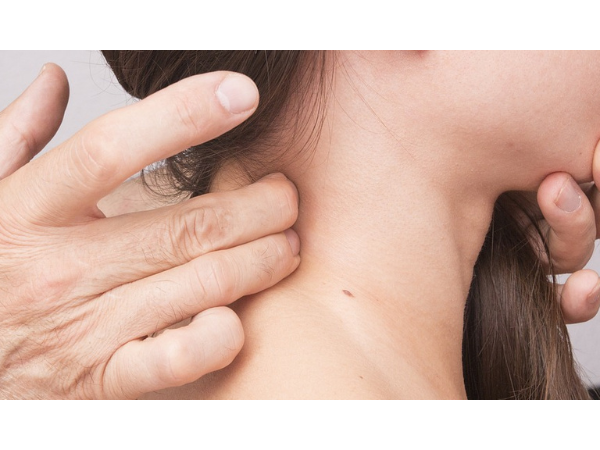 Le Lévothyrox® : crise sanitaire ou crise de société ?