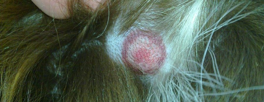 Le vrai scandale de la maladie de Lyme