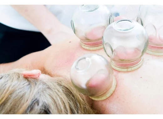 Ventouses, hijama, cupping : une pratique thérapeutique à la mode sans preuve scientifique