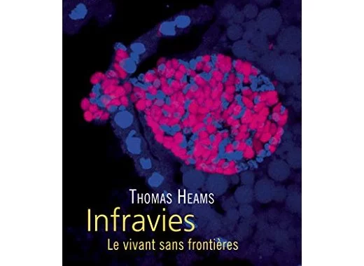 Infravies