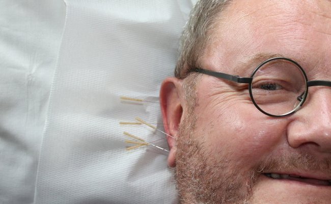 Acupuncture et effet paillasson