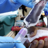 [Conférence en ligne - Mardi 25 février 2025 à 20h00] Les transfusions sanguines : quand les prescrire ? Que craindre ?