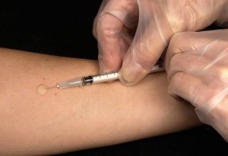 La vaccination contre les papillomavirus : un débat sur des bases irrationnelles