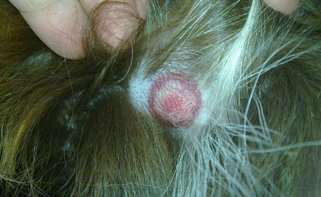 Le vrai scandale de la maladie de Lyme