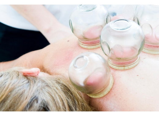 Ventouses, hijama, cupping : une pratique thérapeutique à la mode sans preuve scientifique