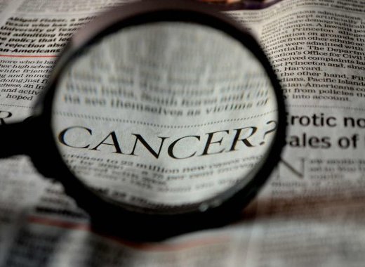 Opinion et causes de cancers