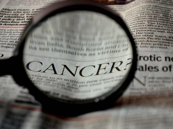 Opinion et causes de cancers