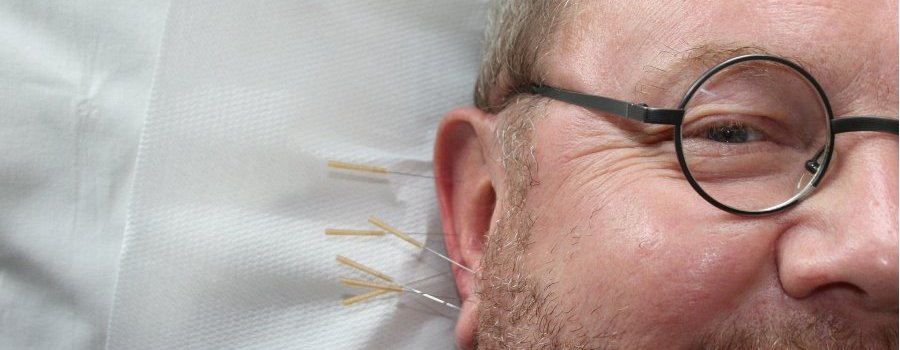 Acupuncture et effet paillasson