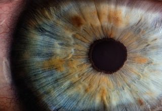 Qu'est-ce que l'iridologie ?