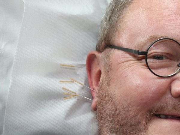 Acupuncture et effet paillasson