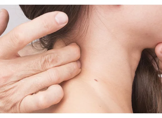 Le Lévothyrox® : crise sanitaire ou crise de société ?