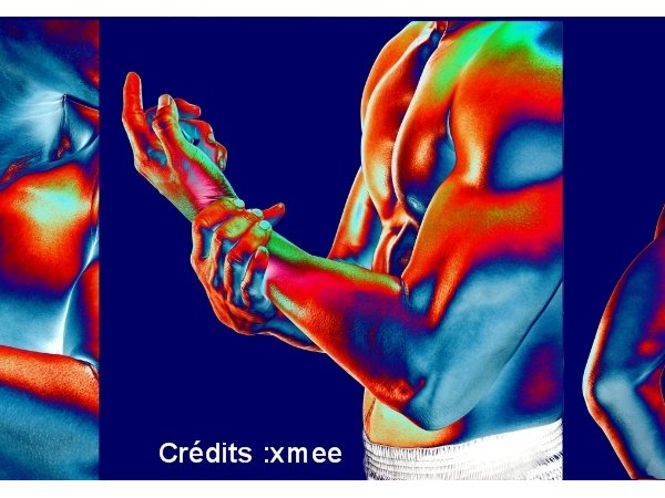 Statines et douleurs musculaires : un cas d'école d'effet nocebo, amplifié par les médias