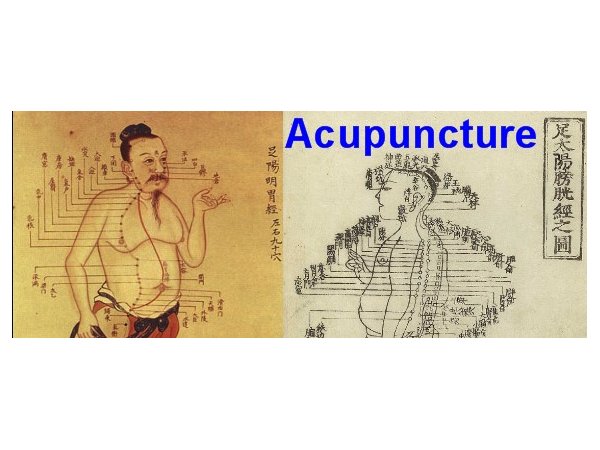 La vérité sur l'acupuncture