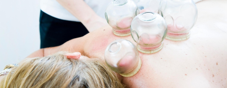 Ventouses, hijama, cupping : une pratique thérapeutique à la mode sans preuve scientifique
