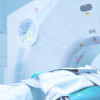 Épidémies apparentes de cancer : comment les pratiques de détection biaisent la surveillance