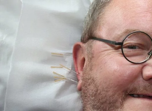 Acupuncture et effet paillasson