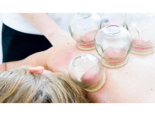 Ventouses, hijama, cupping : une pratique thérapeutique à la mode sans preuve scientifique